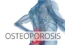 Osteoporosis & Bone Health